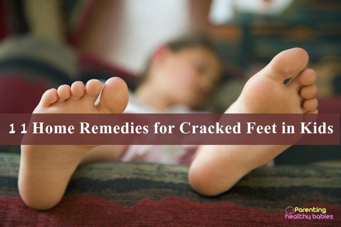 cracked feet in kids