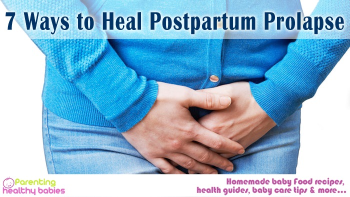 Postpartum Prolapse