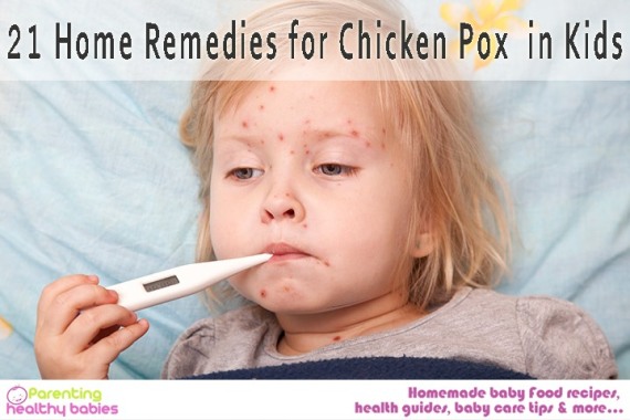 Chicken Pox in Children