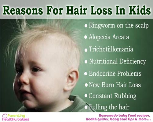 Hair Loss in Kids