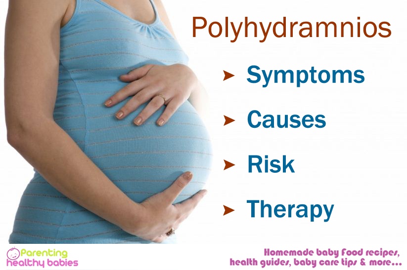 Polyhydramnios, symptoms of Polyhydramnios, causes of Polyhydramnios, Polyhydramnios risks