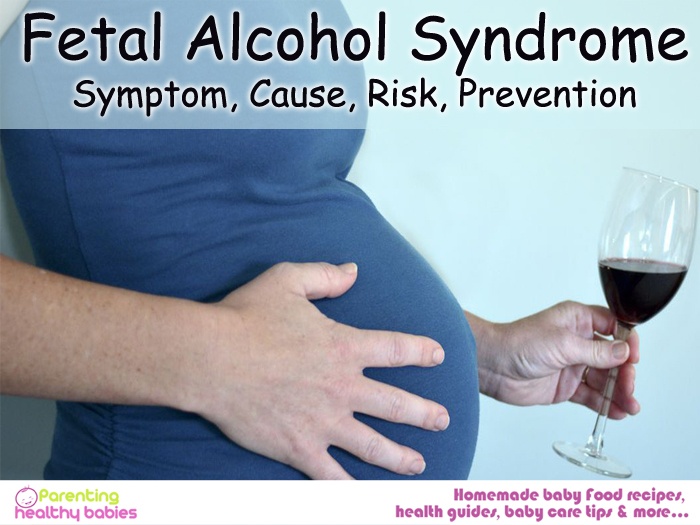 fetal alcohol syndrome, causes of fetal alcohol syndrome, symptoms of fetal alcohol syndrome