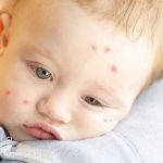 Natural ways to protect your child from mosquito bites