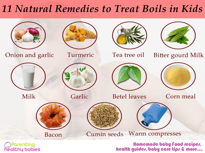 remedies to treat boils in kids