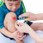 11 Essential Oils For Bruises Healing in Kids