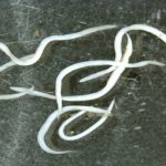 Pinworms in Kids: Symptom, Causes and Treatment
