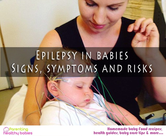 Epilepsy in babies