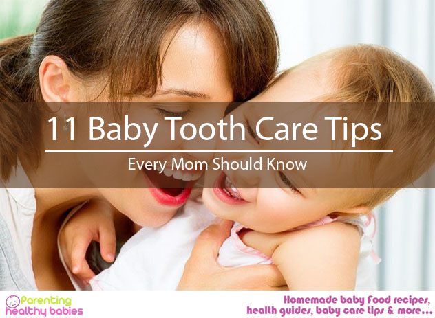 Baby Tooth Care Tips