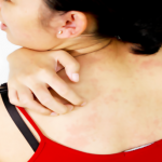 Itchy Skin during Pregnancy: Do I need to be worried?
