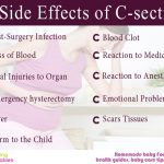 11 Side effects of C-section no one told you about