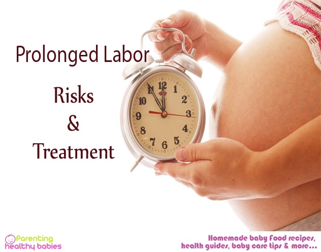 prolonged labor risk