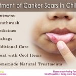 Cause and Treatment of Canker Sores in Children