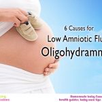 6 Causes for low amniotic fluid: Oligohydramnios