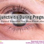 Conjunctivitis During Pregnancy