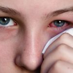 Conjunctivitis during pregnancy: 11 natural remedies you must know about
