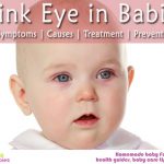 Pink Eye in Babies: Symptoms, Causes, Treatment and Prevention