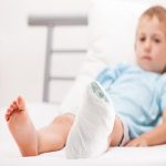 Sever’s Disease in Children