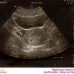 Week 3 of Pregnancy: Pregnancy Week By Week