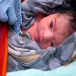 c section delivery