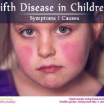 Symptoms and Causes of Fifth disease in children