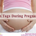 skin tags during pregnancy