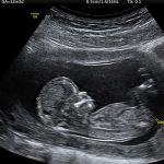WEEK 12 OF PREGNANCY – PREGNANCY WEEK BY WEEK