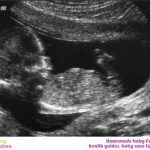 week 14 pregnancy