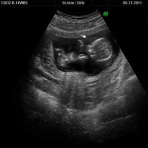 week 14 pregnancy