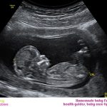 Week 15 of Pregnancy – Pregnancy Week by Week