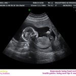 week 16 pregnancy