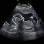 week 16 pregnancy