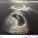 Week 7 of pregnancy: pregnancy week by week