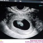 WEEK 8 OF PREGNANCY – PREGNANCY WEEK BY WEEK