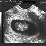 WEEK 8 OF PREGNANCY – PREGNANCY WEEK BY WEEK