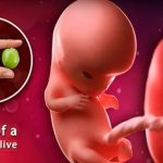 week 9 fetus