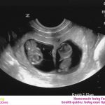 WEEK 9 OF PREGNANCY – PREGNANCY WEEK BY WEEK