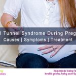 Carpal Tunnel Syndrome during Pregnancy: Causes, Symptoms, Treatment