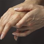 Carpal Tunnel Syndrome during Pregnancy: Causes, Symptoms, Treatment