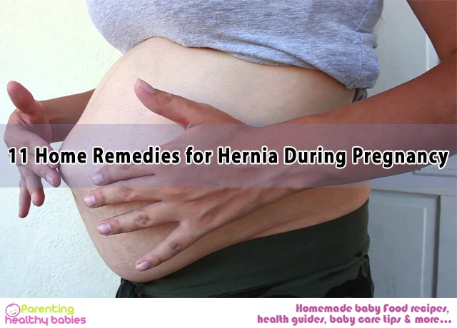 Hernia During Pregnancy