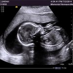 WEEK 27 OF PREGNANCY – PREGNANCY WEEK BY WEEK