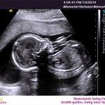 WEEK 27 OF PREGNANCY – PREGNANCY WEEK BY WEEK