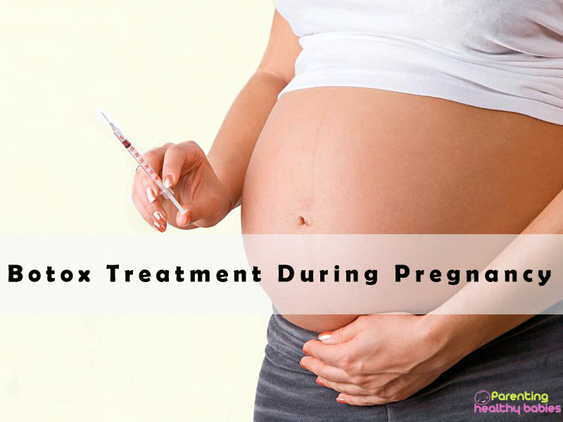 botox during pregnancy