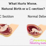natural birth