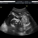 WEEK 31 OF PREGNANCY – PREGNANCY WEEK BY WEEK