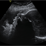 35 weeks pregnancy ultrasound