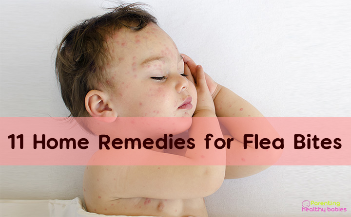 home remedies for flea bites