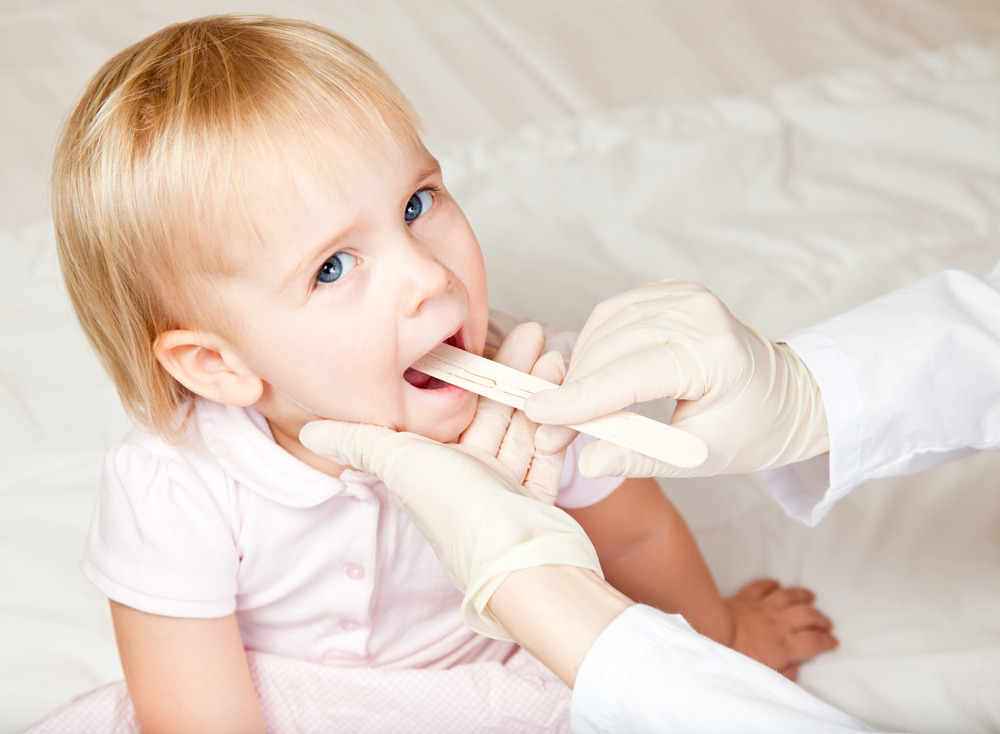 tonsils stones in children