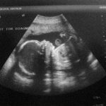 Week 25 of Pregnancy – Pregnancy Week By Week