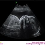 WEEK 29 OF PREGNANCY – PREGNANCY WEEK BY WEEK