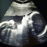 WEEK 29 OF PREGNANCY – PREGNANCY WEEK BY WEEK